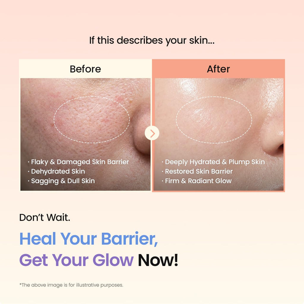 BIODANCE Barrier Rescue Duo: Caviar PDRN & Ceramide Panthenol Real Deep Overnight Gel Mask for Hydrating Plumping for Glass Skin, Korean Skin Care, Skin Care Set
